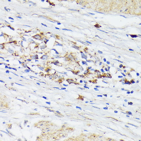 Anti-TREM2 Rabbit Polyclonal Antibody