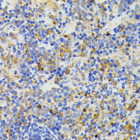 Anti-TREM2 Rabbit Polyclonal Antibody