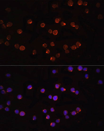 Anti-IL-1 beta Rabbit Polyclonal Antibody
