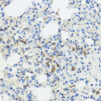 Anti-IL-1 beta Rabbit Polyclonal Antibody