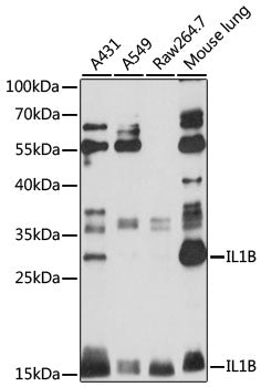 Anti-IL-1 beta Rabbit Polyclonal Antibody