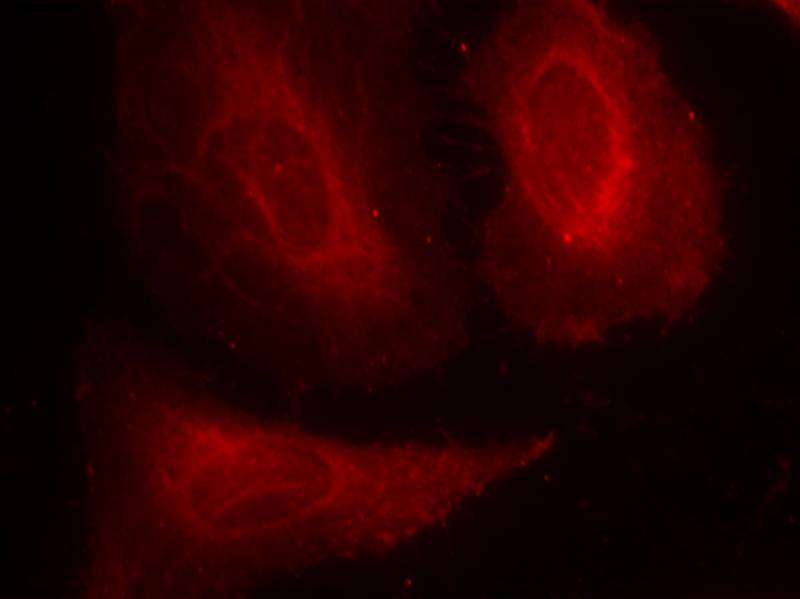 Anti-Phospho-PDPK1 (Ser241) Rabbit Polyclonal Antibody