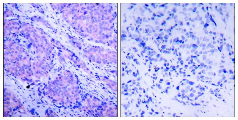 Anti-Phospho-PDPK1 (Ser241) Rabbit Polyclonal Antibody