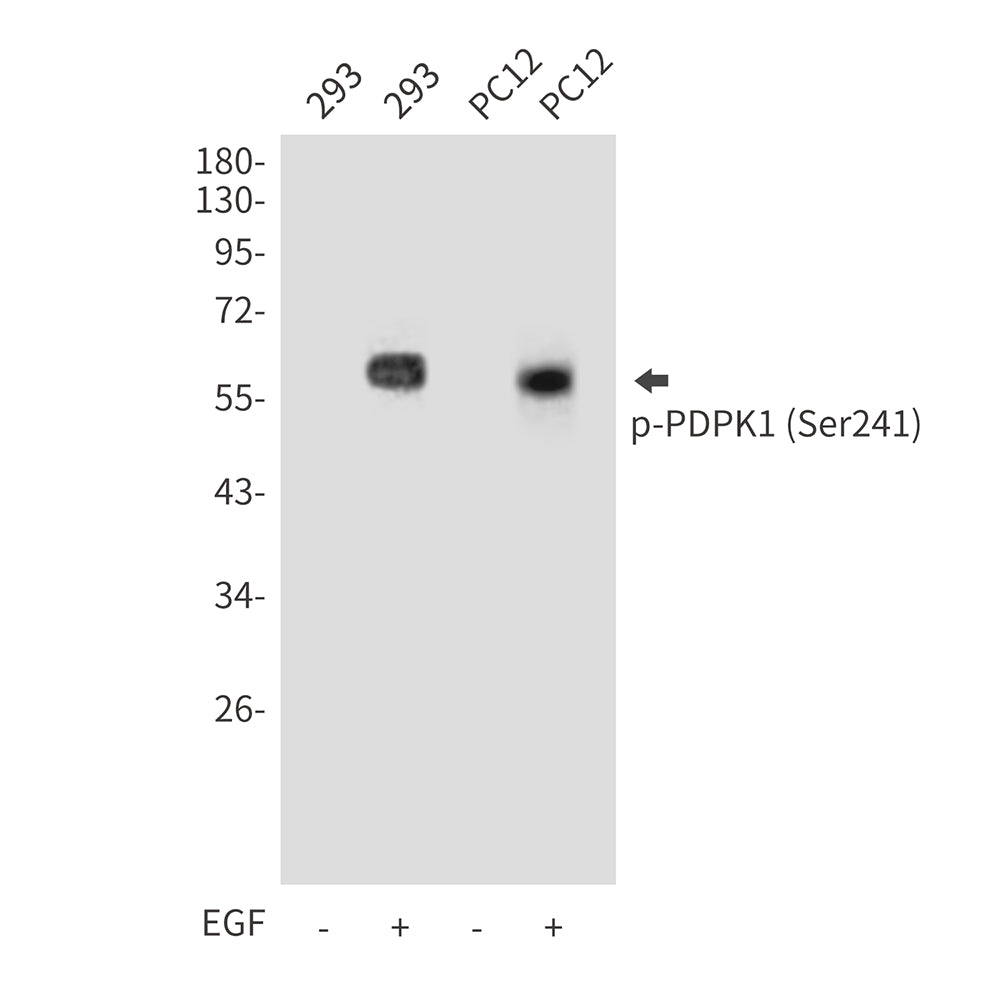 Anti-Phospho-PDPK1 (Ser241) Rabbit Polyclonal Antibody