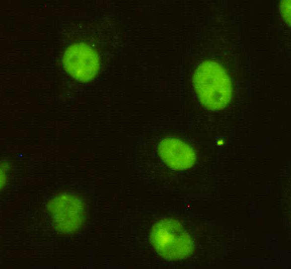 Anti-DBC 1 (3G4) Mouse Monoclonal Antibody