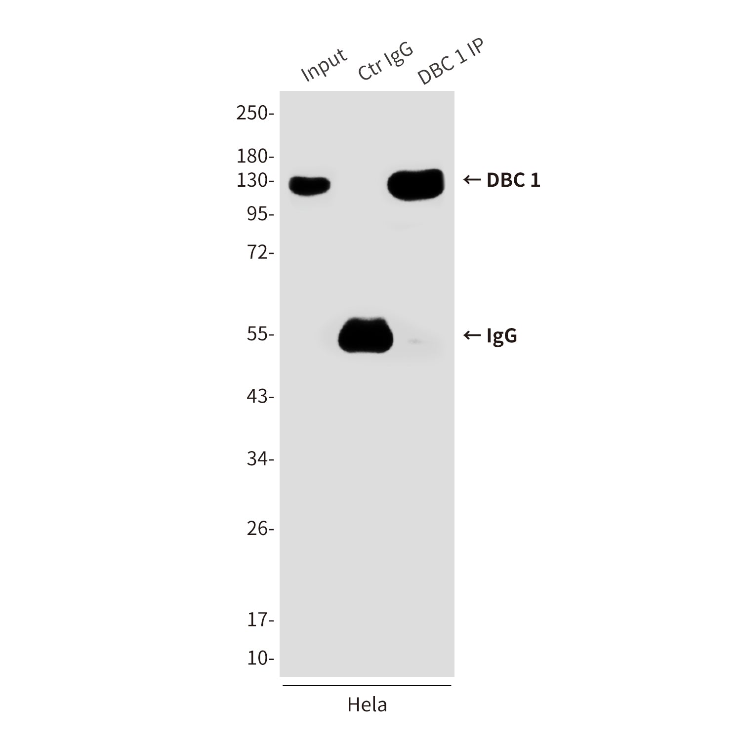Anti-DBC 1 (3G4) Mouse Monoclonal Antibody