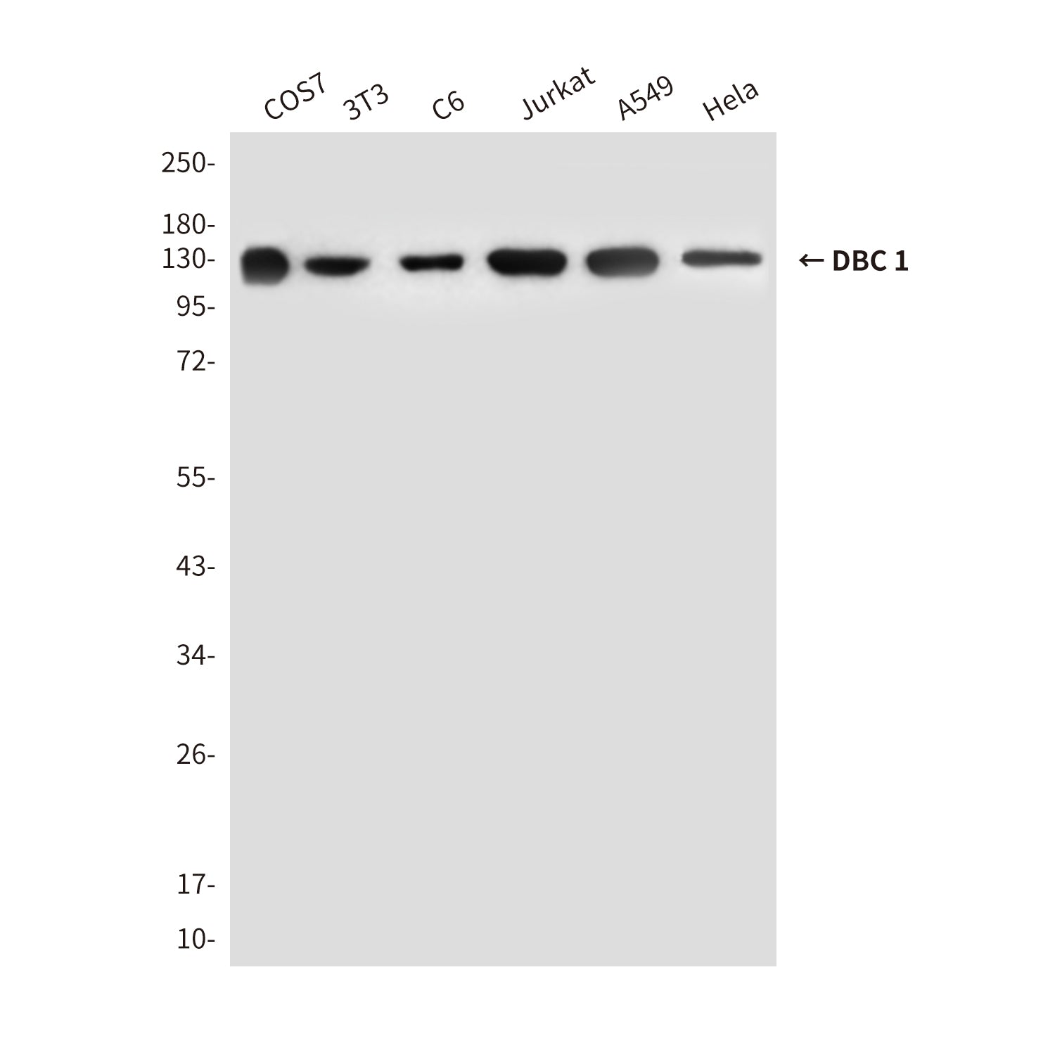 Anti-DBC 1 (3G4) Mouse Monoclonal Antibody
