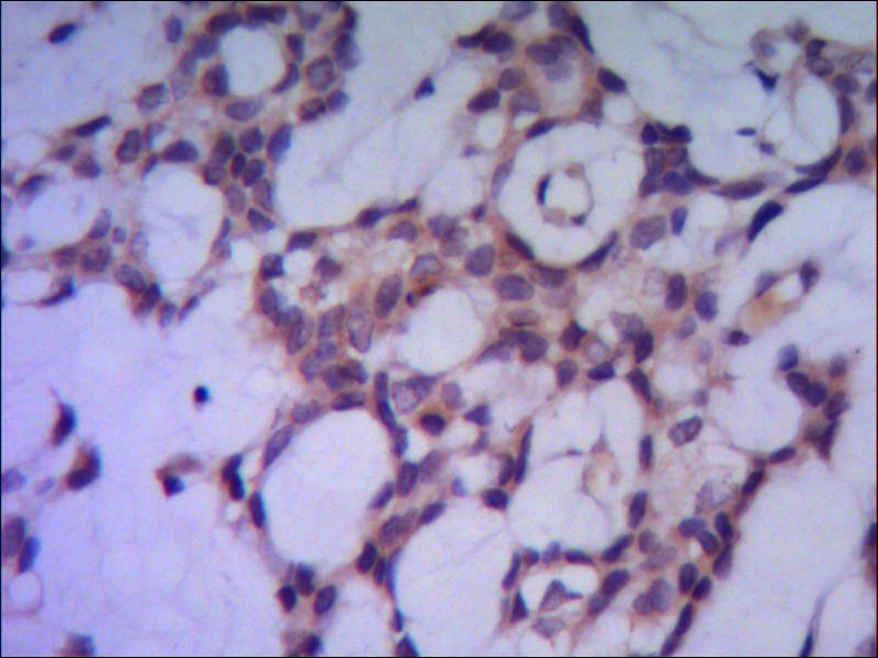 Anti-PP1C alpha (1C11) Mouse Monoclonal Antibody