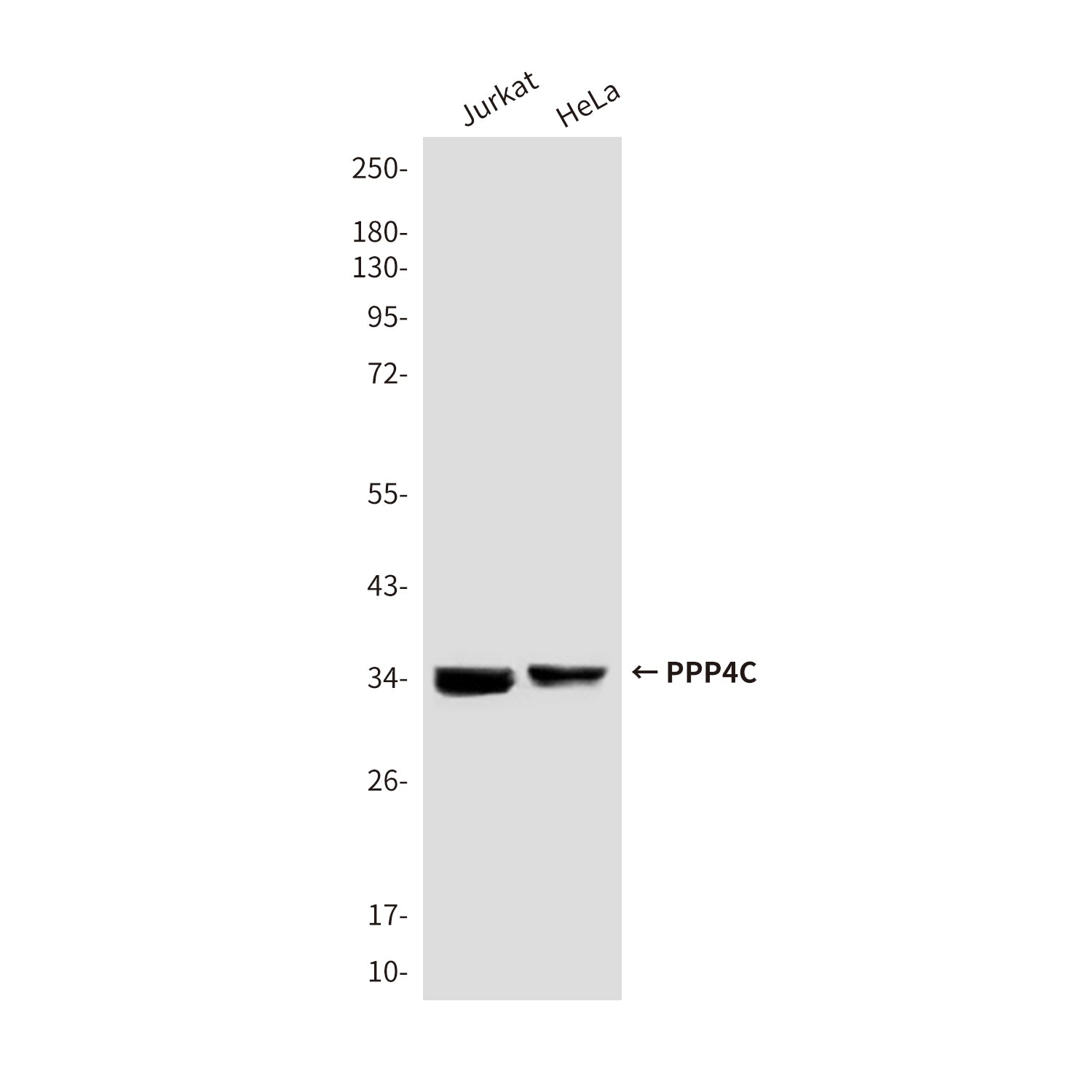 Anti-PPP4C (2F11) Mouse Monoclonal Antibody