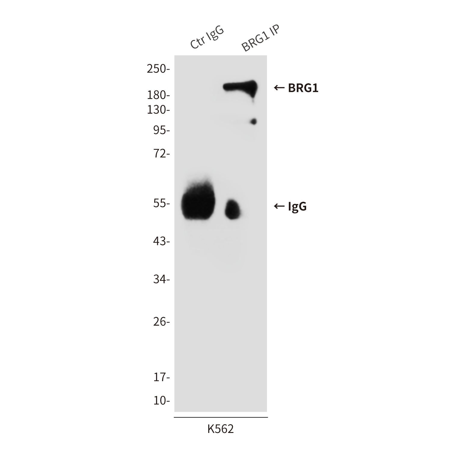 Anti-BRG1 (4E11) Mouse Monoclonal Antibody