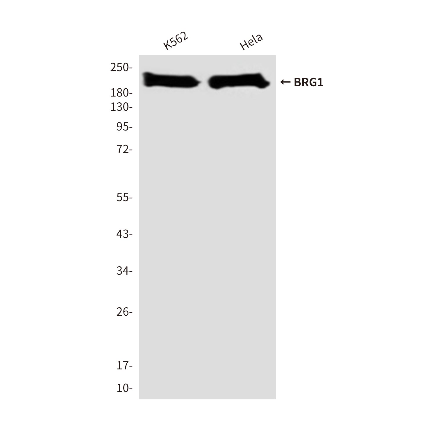 Anti-BRG1 (4E11) Mouse Monoclonal Antibody