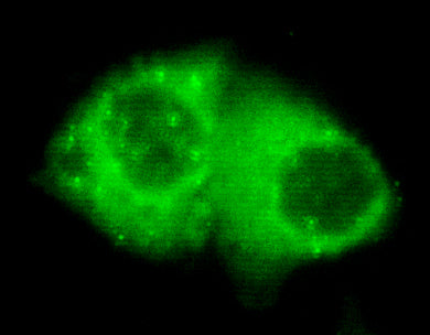Anti-Cytokeratin 7 (4G9) Mouse Monoclonal Antibody