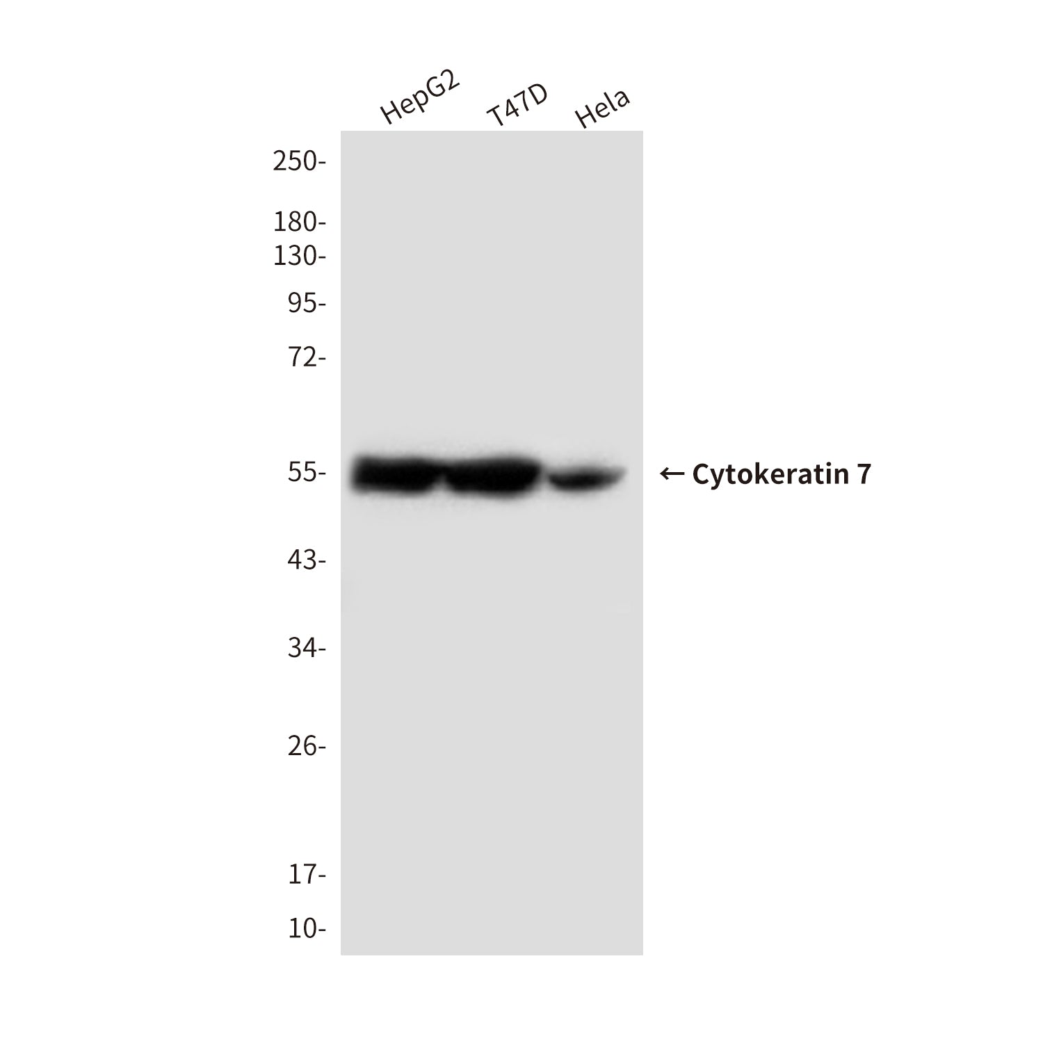 Anti-Cytokeratin 7 (4G9) Mouse Monoclonal Antibody
