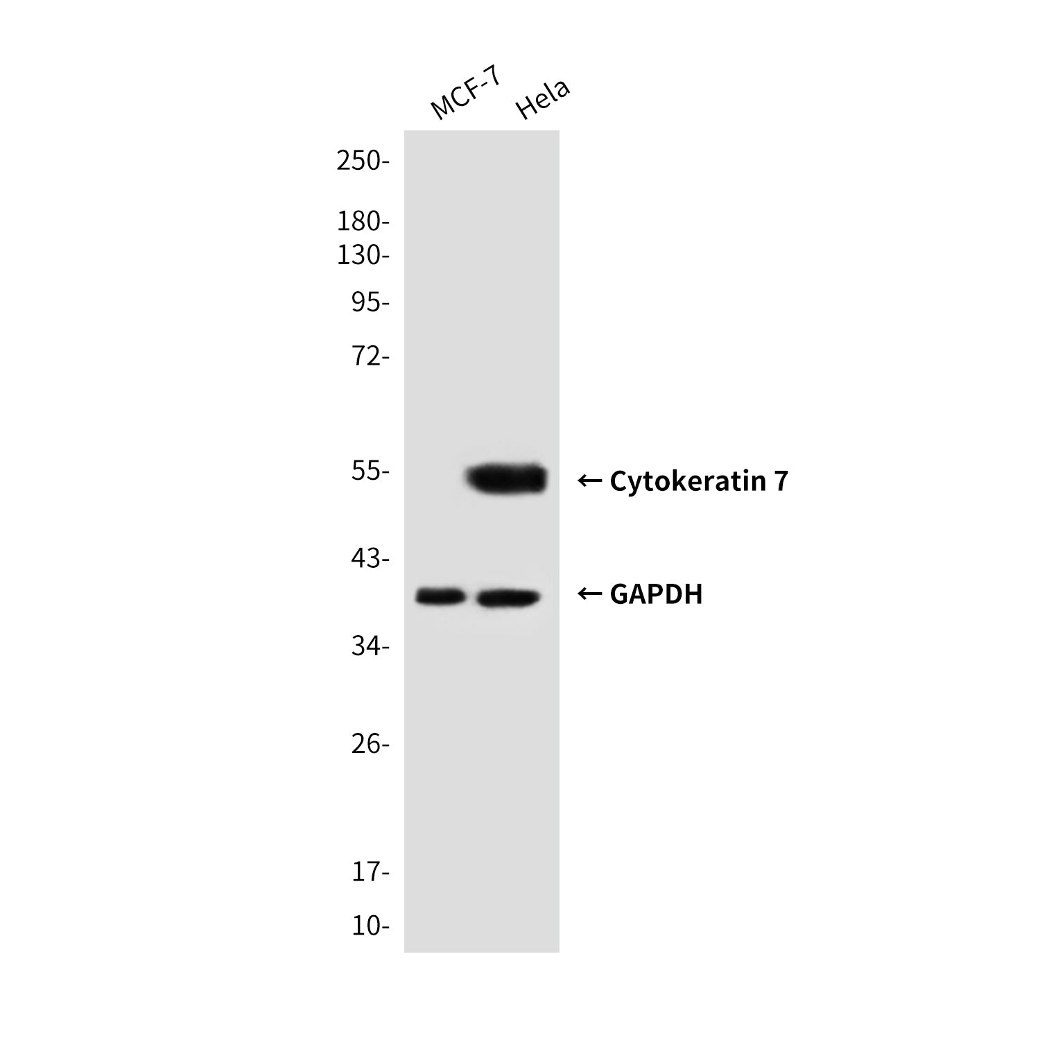 Anti-Cytokeratin 7 (4G9) Mouse Monoclonal Antibody