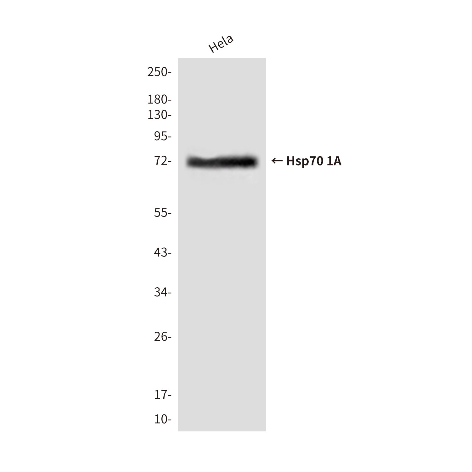 Anti-Hsp70 1A (2A11) Mouse Monoclonal Antibody