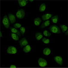 Anti-TBL1XR1 (4F3) Mouse Monoclonal Antibody