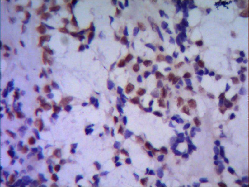 Anti-TBL1XR1 (4F3) Mouse Monoclonal Antibody