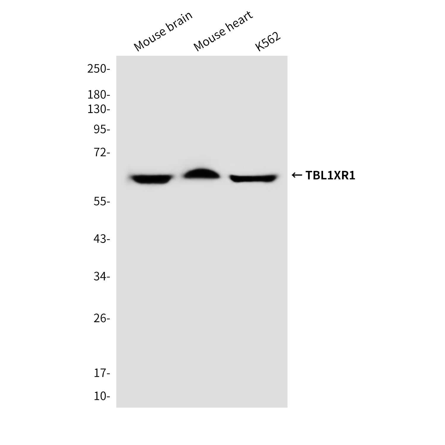 Anti-TBL1XR1 (4F3) Mouse Monoclonal Antibody