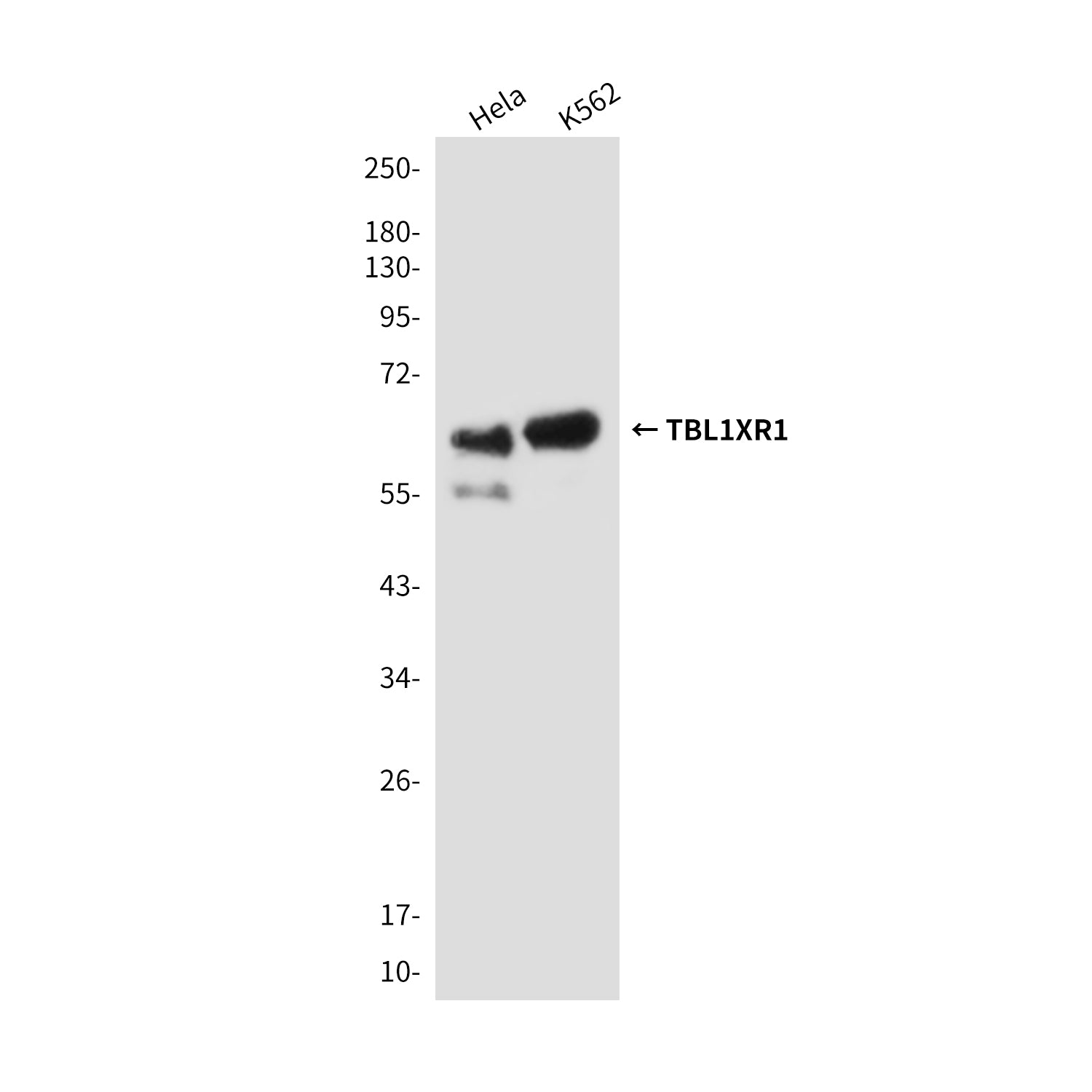 Anti-TBL1XR1 (4F3) Mouse Monoclonal Antibody