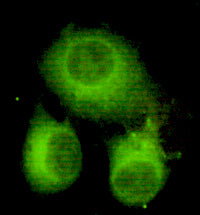 Anti-ATP Citrate Lyase (3D9) Mouse Monoclonal Antibody