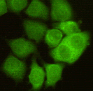 Anti-CDK1 (3B9) Mouse Monoclonal Antibody