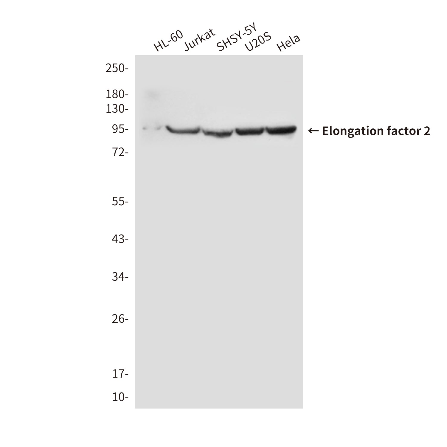 Anti-Elongation factor 2 (4B3) Mouse Monoclonal Antibody