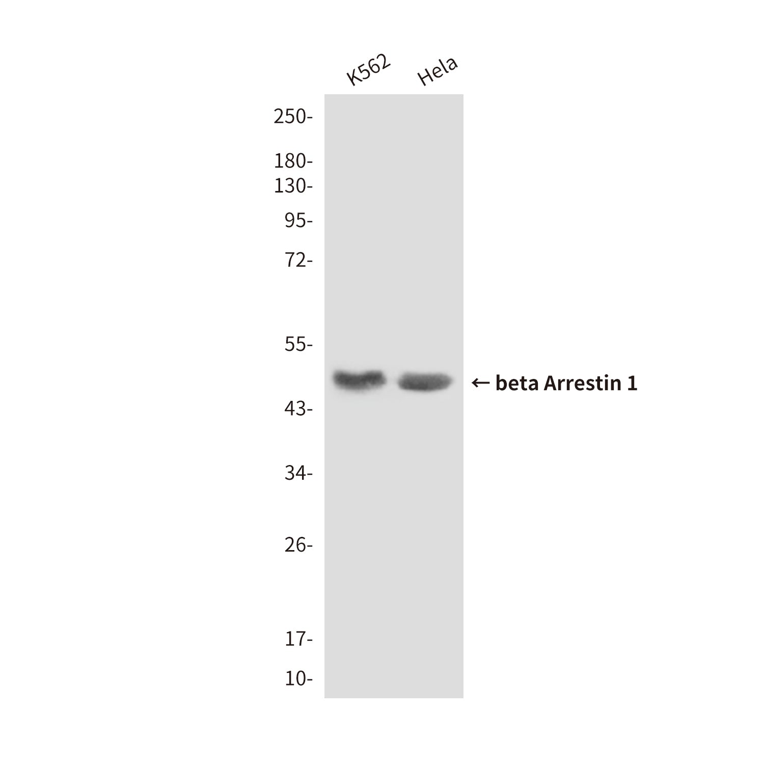 Anti-beta Arrestin 1 (6A1) Mouse Monoclonal Antibody