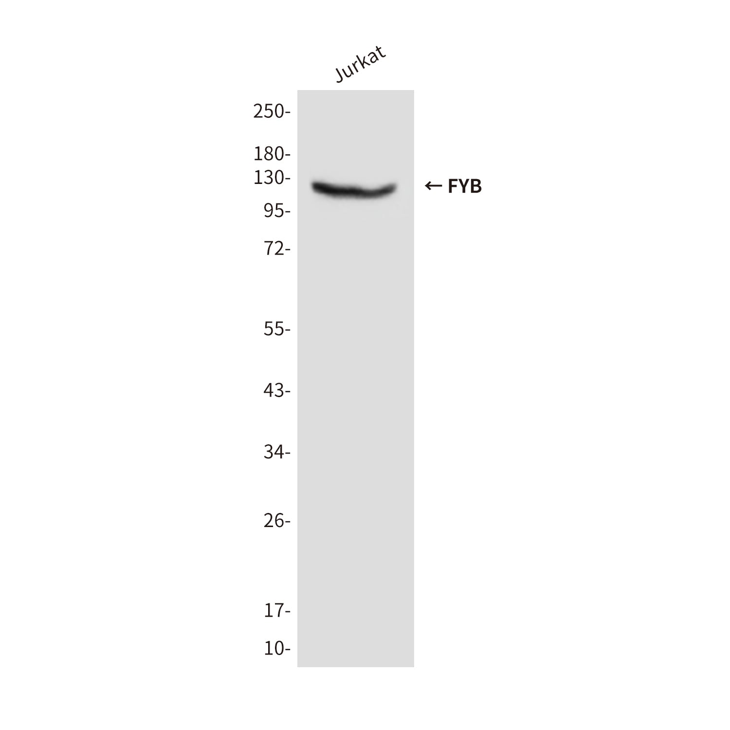 Anti-FYB (2H9) Mouse Monoclonal Antibody