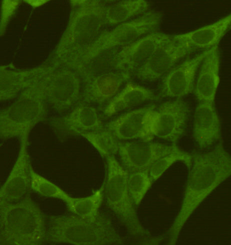 Anti-PKM2 (1F2) Mouse Monoclonal Antibody