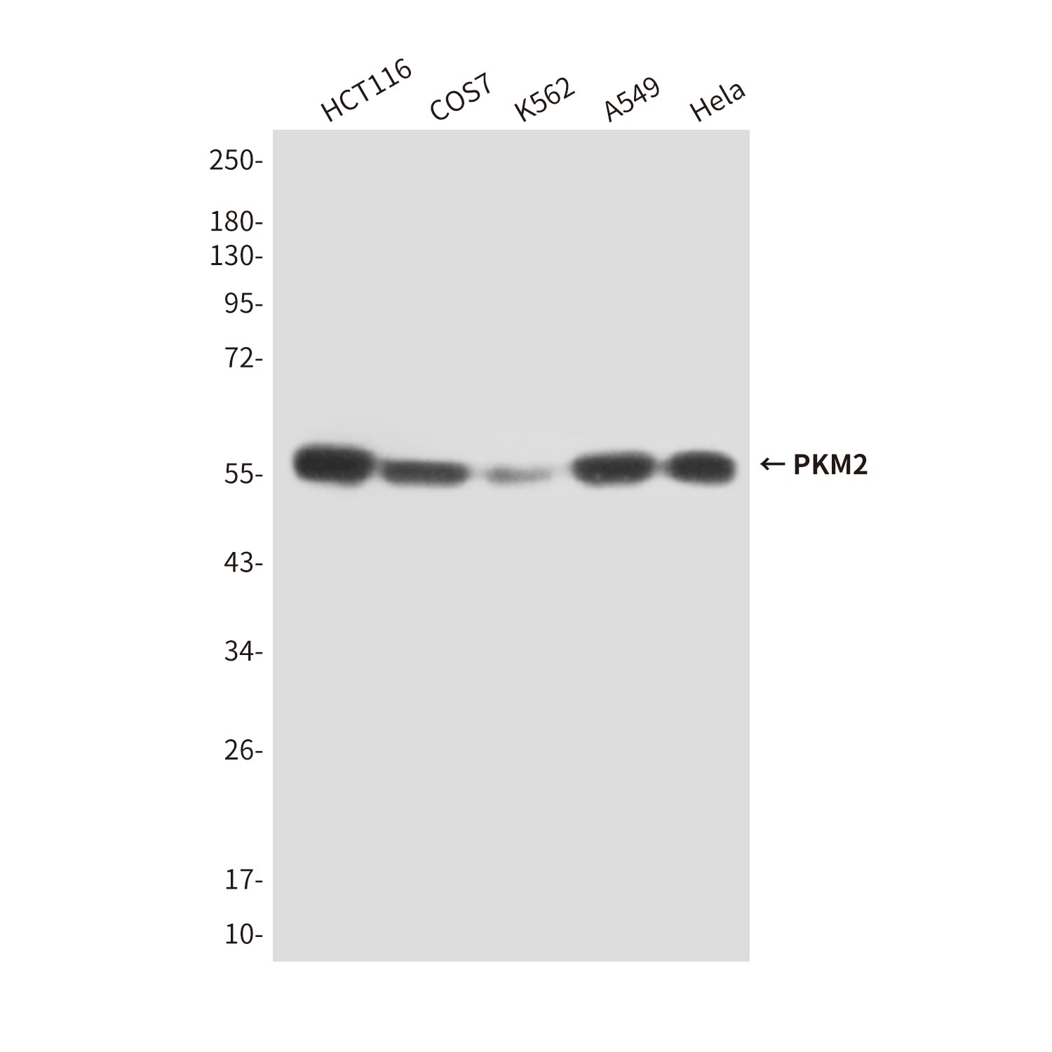Anti-PKM2 (1F2) Mouse Monoclonal Antibody