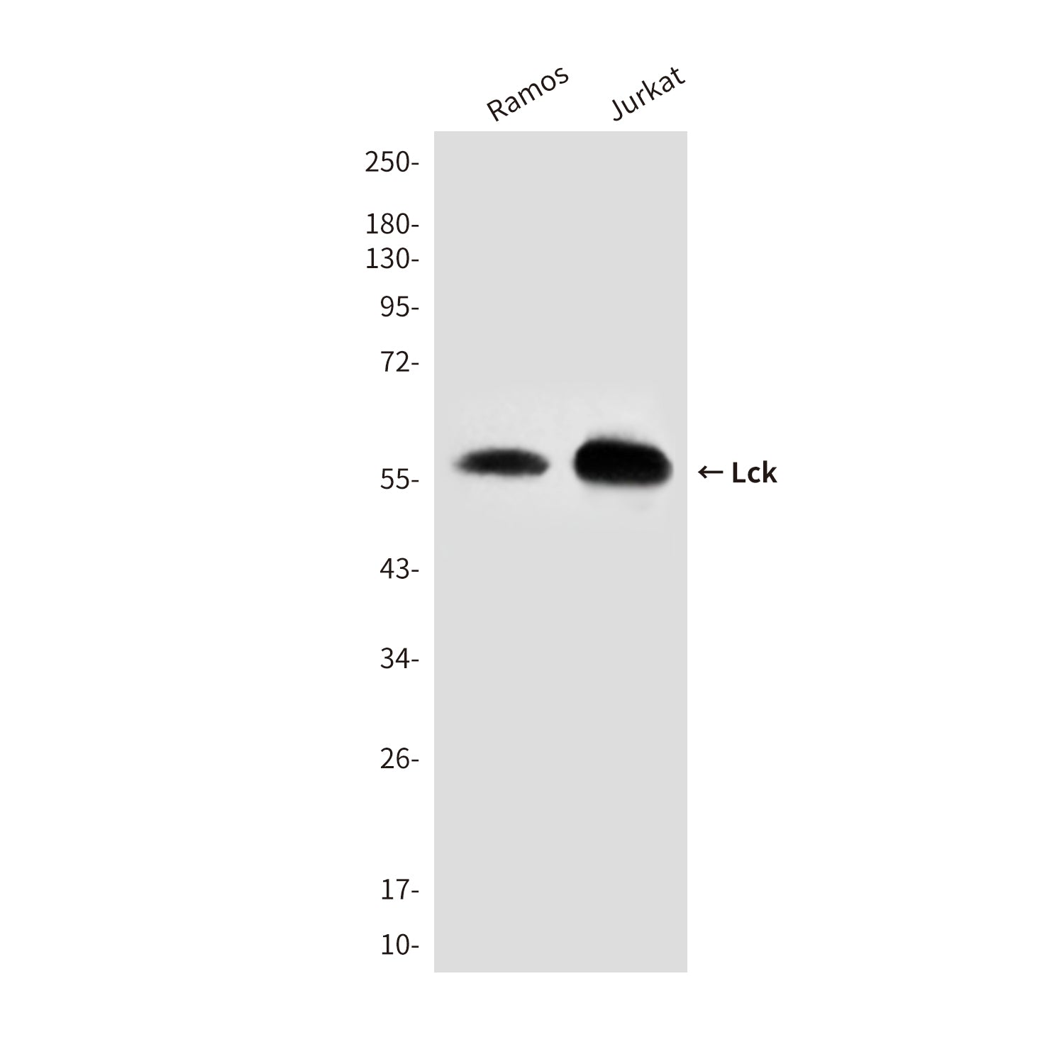 Anti-Lck (3E5) Mouse Monoclonal Antibody