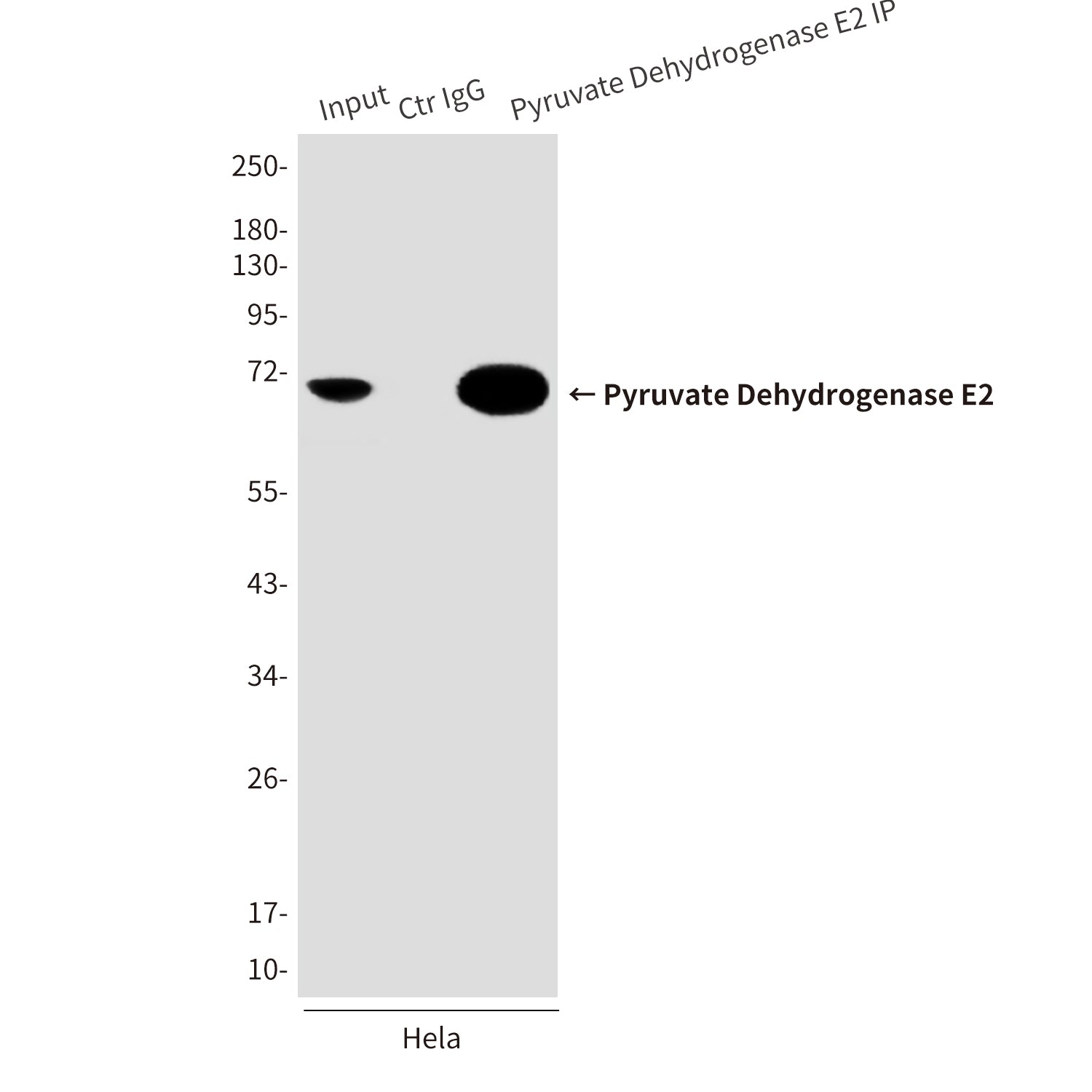 Anti-Pyruvate Dehydrogenase E2 (4A4) Mouse Monoclonal Antibody