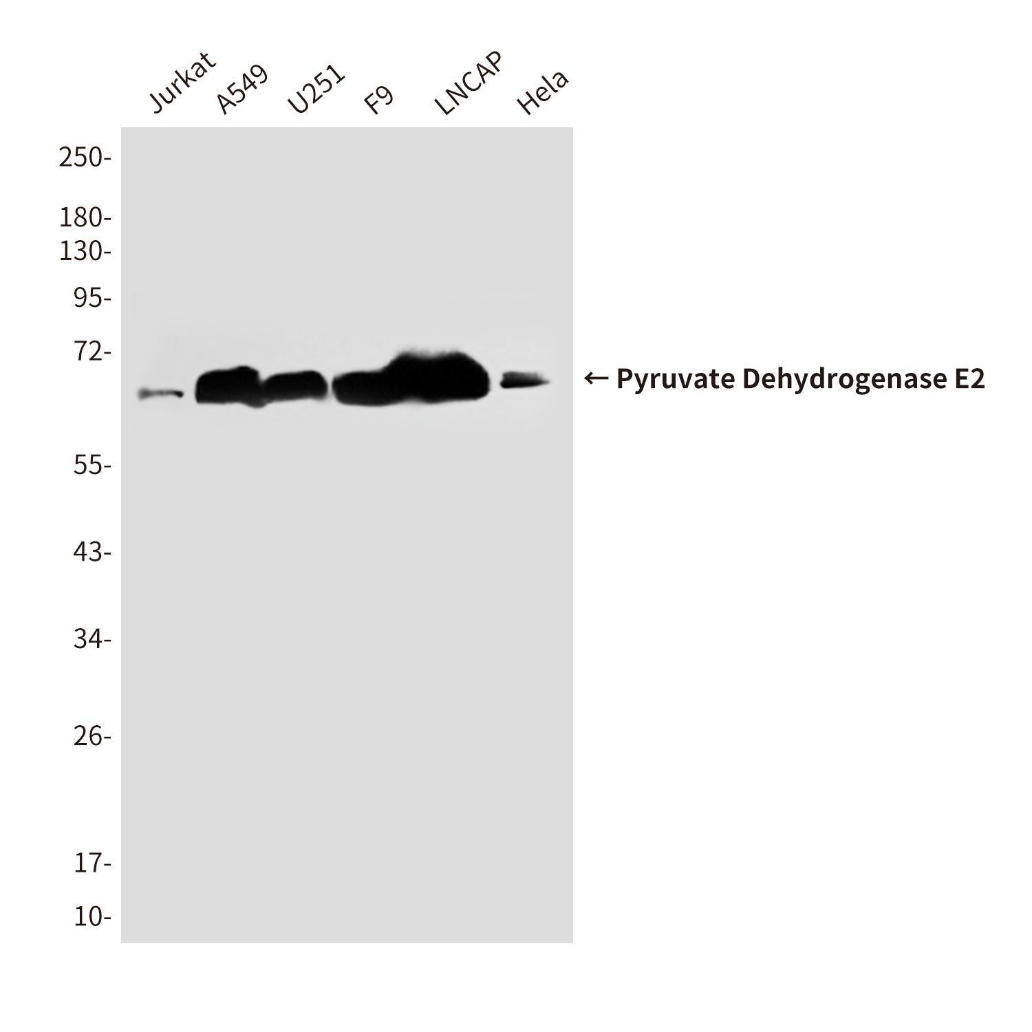 Anti-Pyruvate Dehydrogenase E2 (4A4) Mouse Monoclonal Antibody