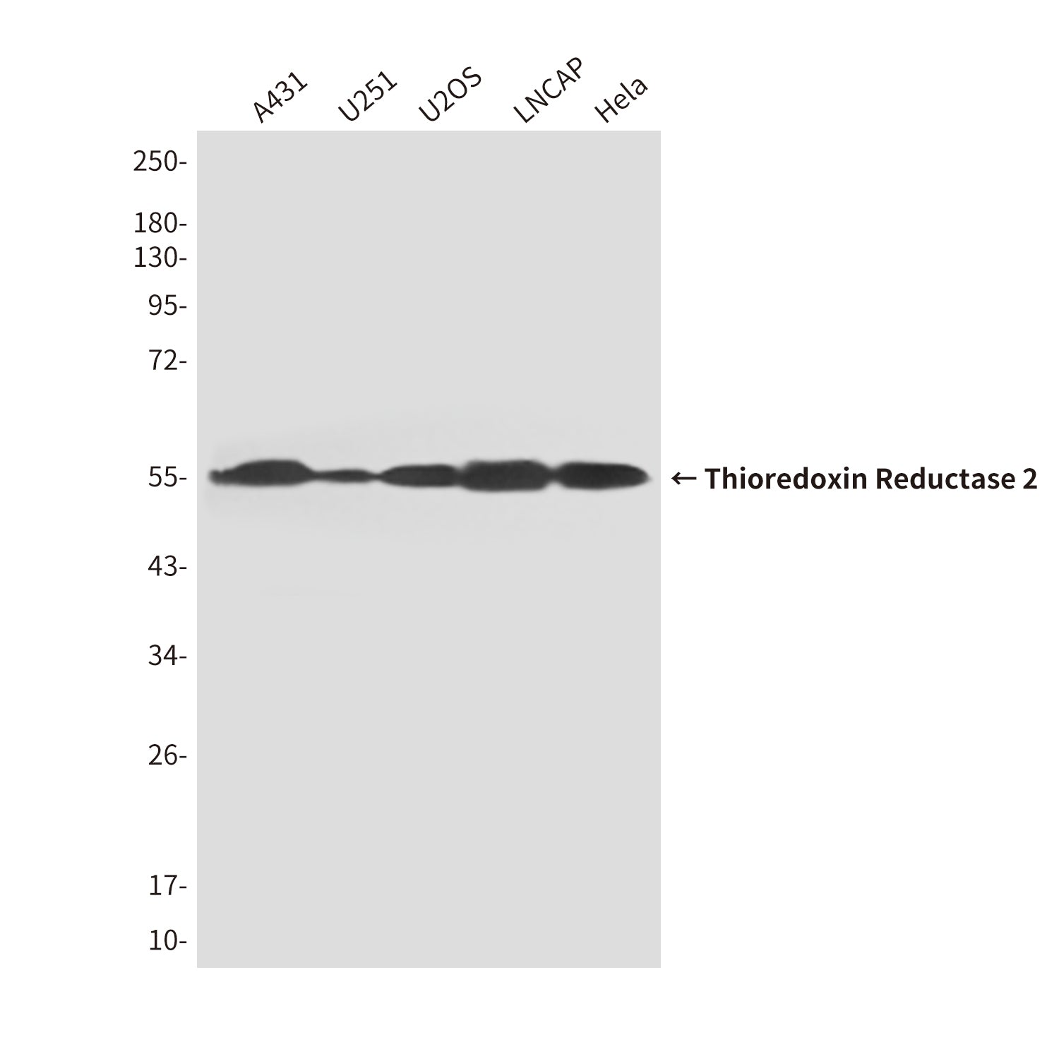Anti-Thioredoxin Reductase 2 (3F2) Mouse Monoclonal Antibody