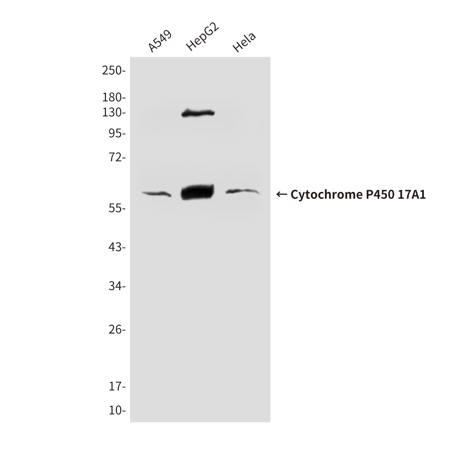 Anti-Cytochrome P450 17A1 (6E1) Mouse Monoclonal Antibody