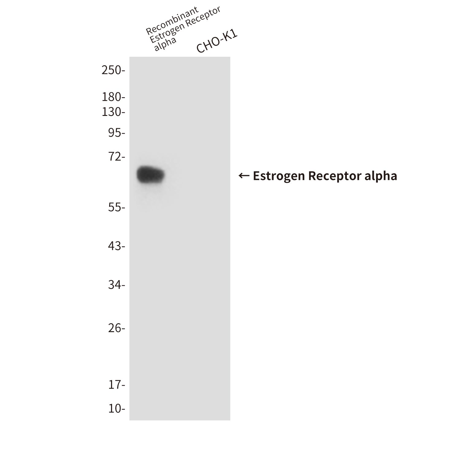 Anti-Estrogen Receptor alpha (6F11) Mouse Monoclonal Antibody
