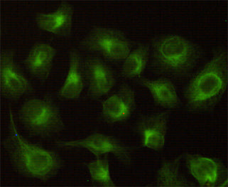 Anti-CBR1 (2C9) Mouse Monoclonal Antibody
