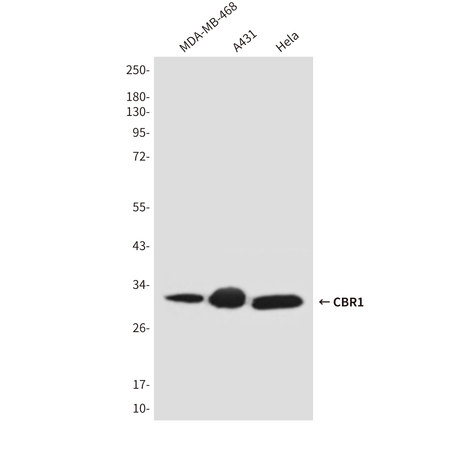 Anti-CBR1 (2C9) Mouse Monoclonal Antibody