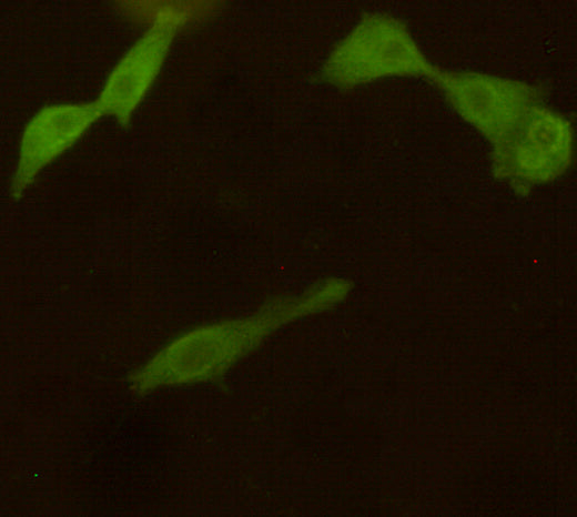 Anti-PGP9.5 (7B8) Mouse Monoclonal Antibody