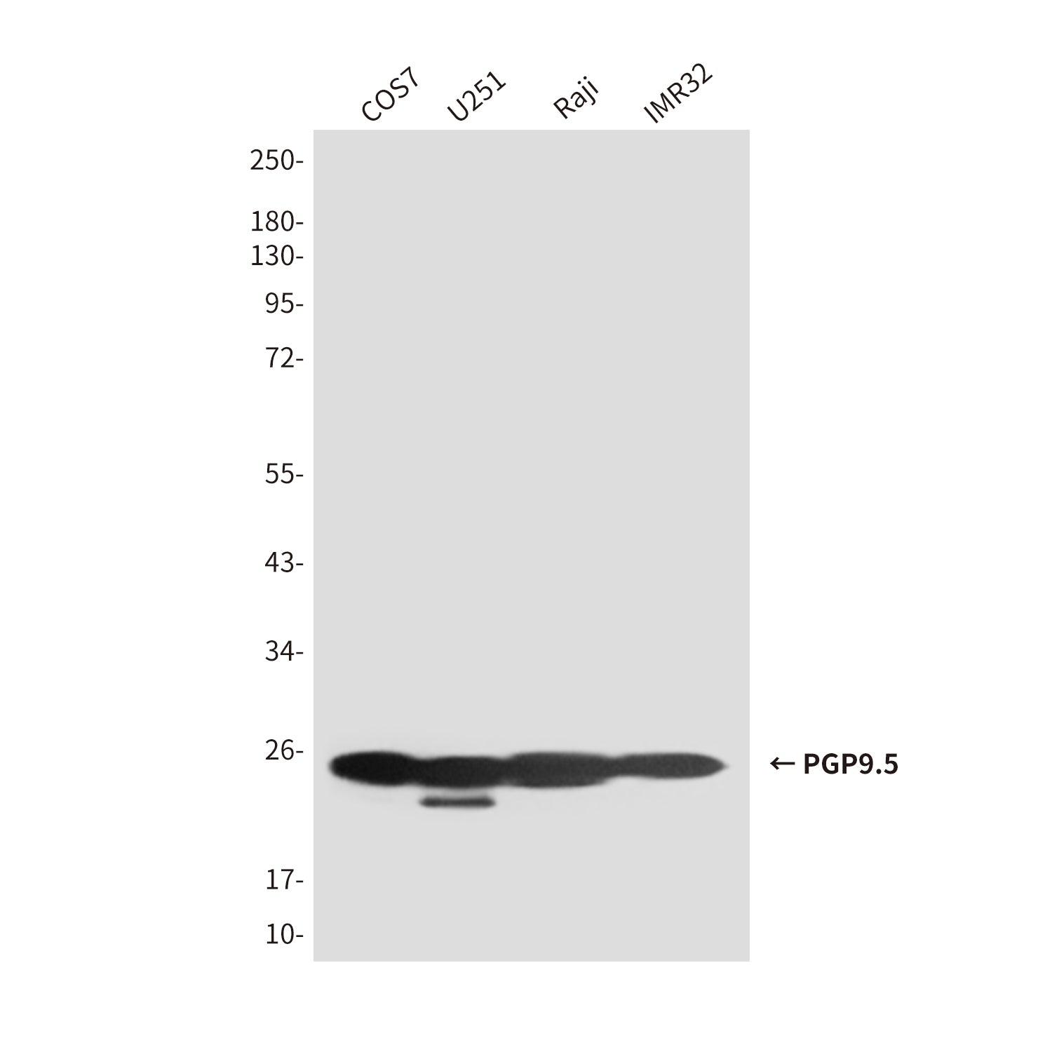 Anti-PGP9.5 (7B8) Mouse Monoclonal Antibody