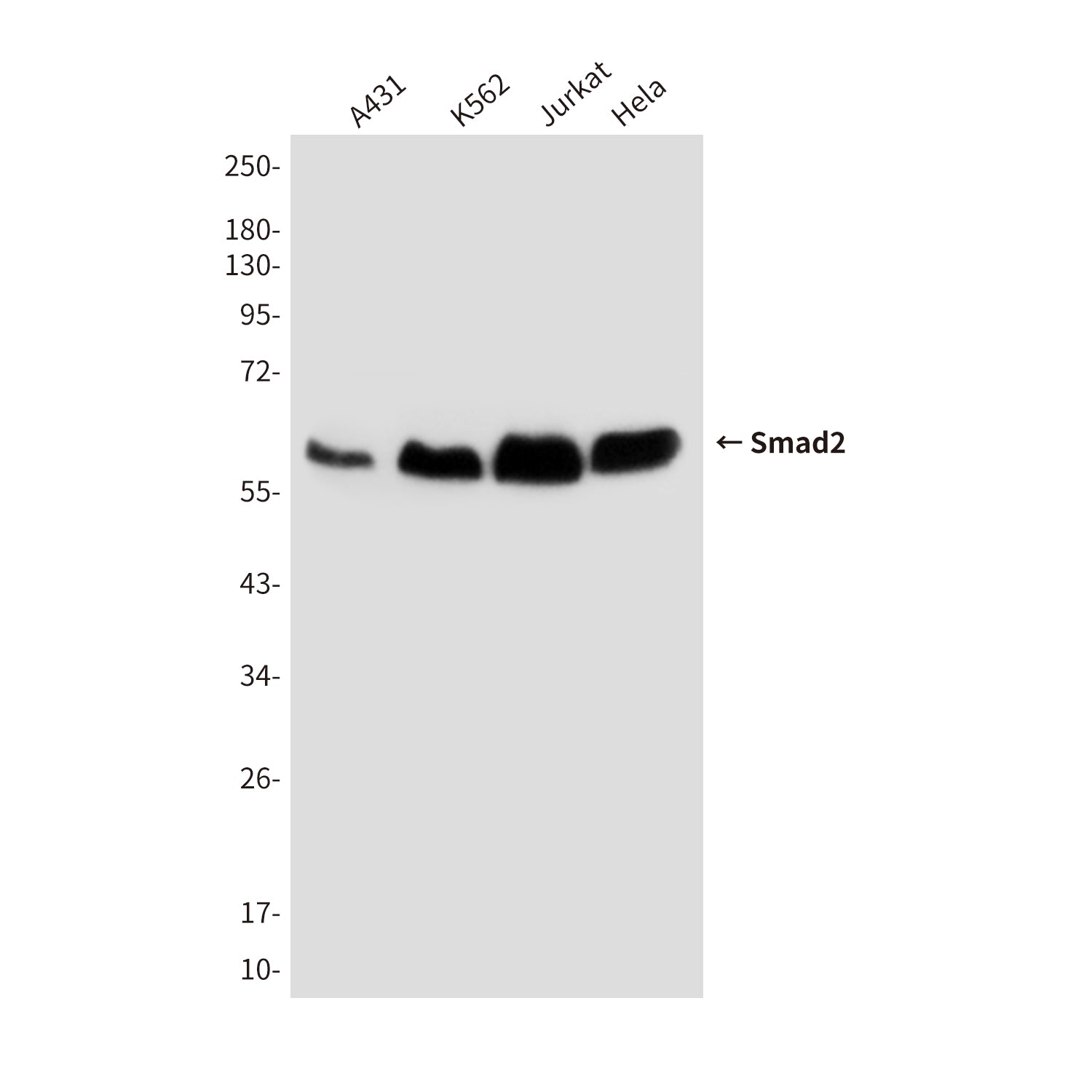 Anti-Smad2 (6H5) Mouse Monoclonal Antibody