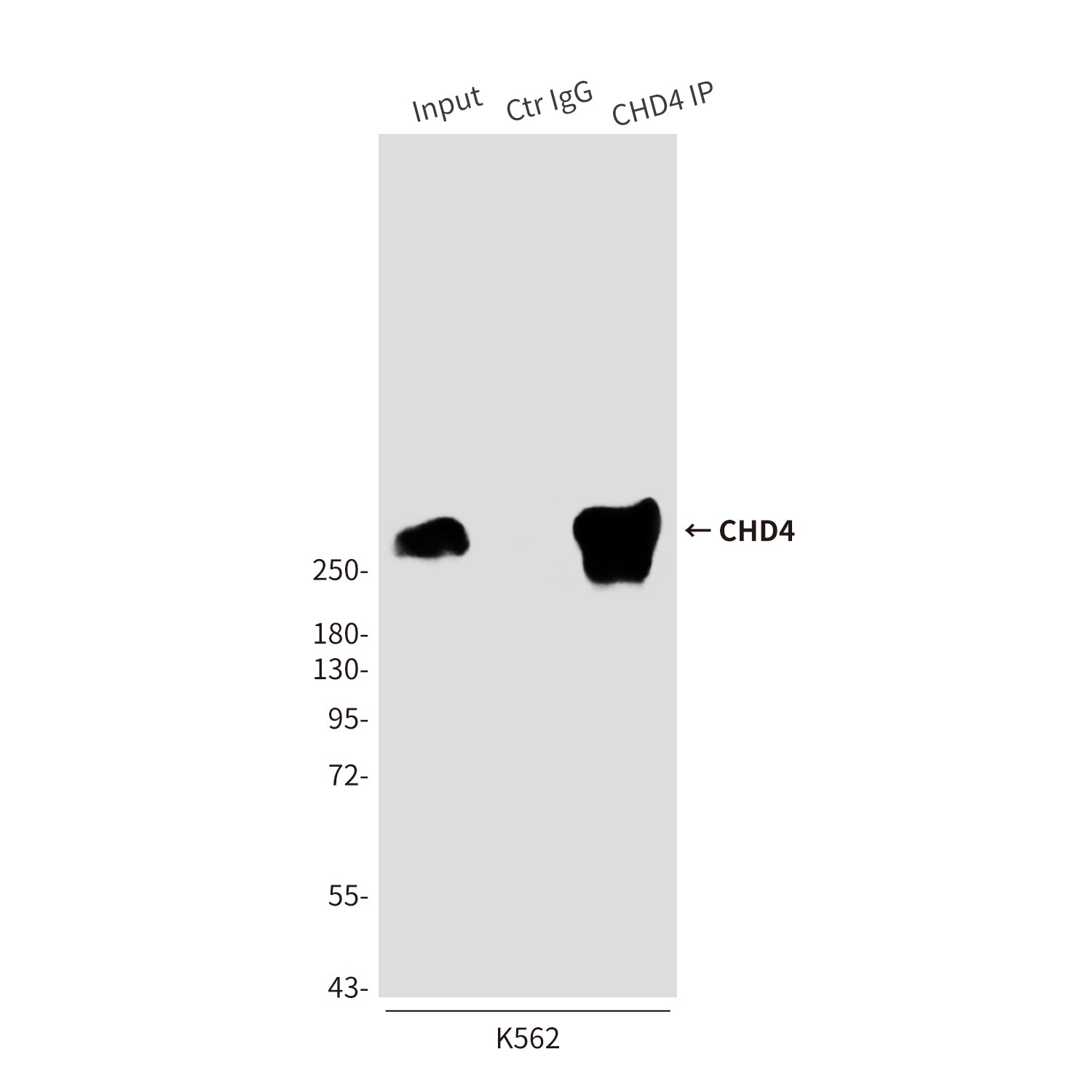 Anti-CHD4 (5F1) Mouse Monoclonal Antibody