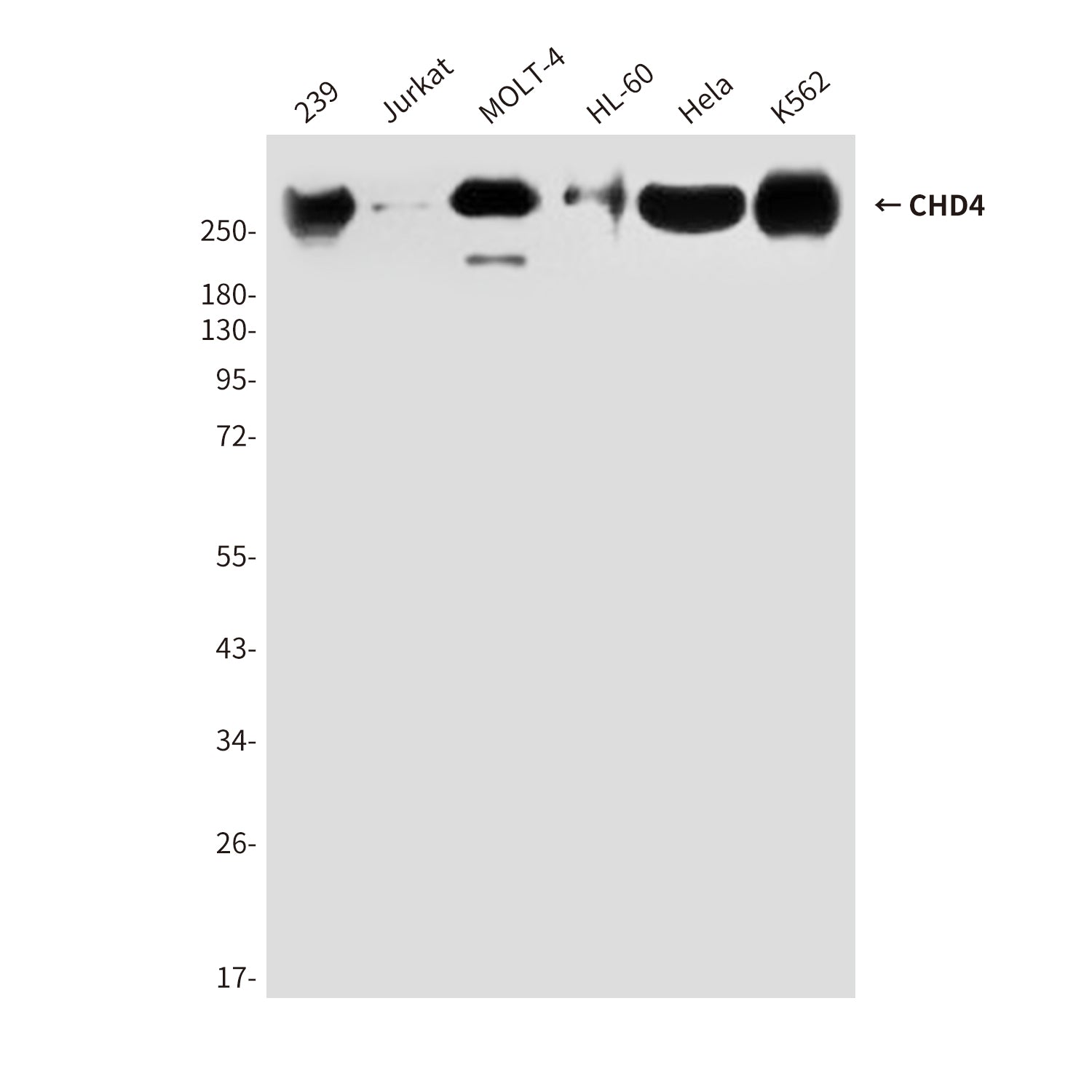 Anti-CHD4 (5F1) Mouse Monoclonal Antibody