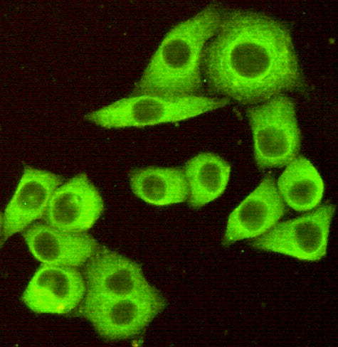 Anti-TNFRSF10B (7F4) Mouse Monoclonal Antibody