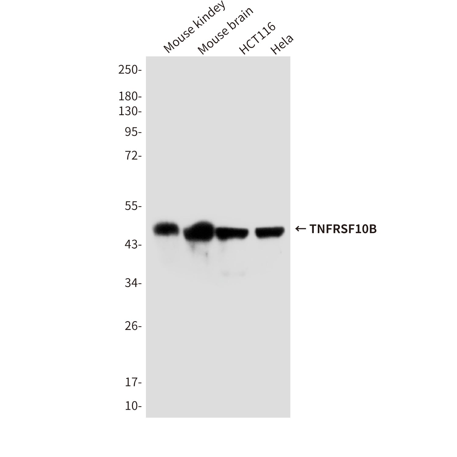 Anti-TNFRSF10B (7F4) Mouse Monoclonal Antibody