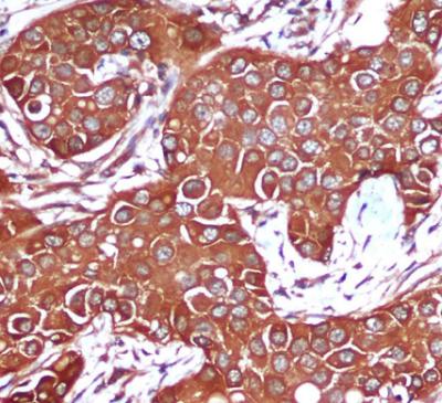 Anti-AMPK beta 1 (1A7) Mouse Monoclonal Antibody