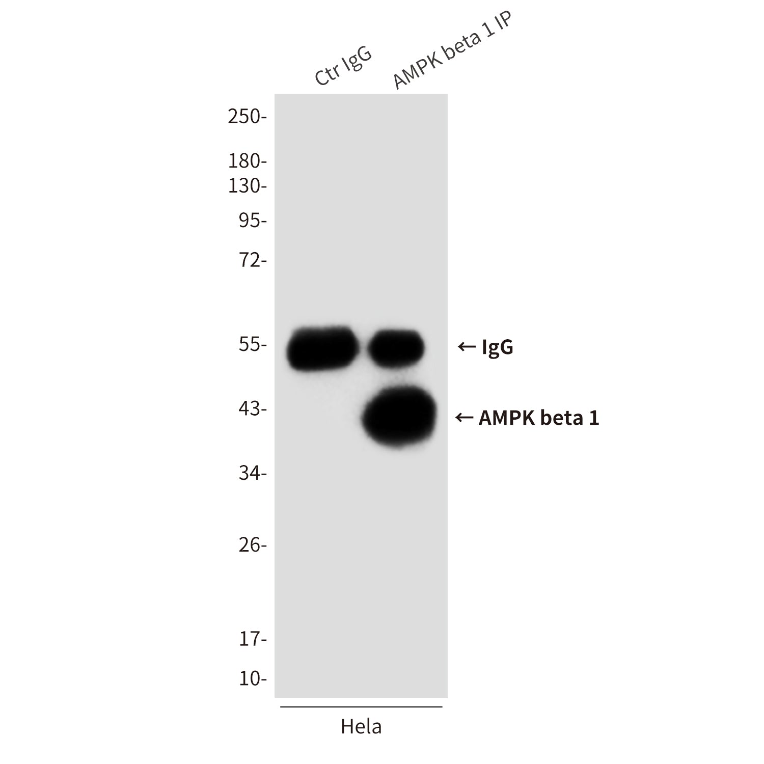 Anti-AMPK beta 1 (1A7) Mouse Monoclonal Antibody