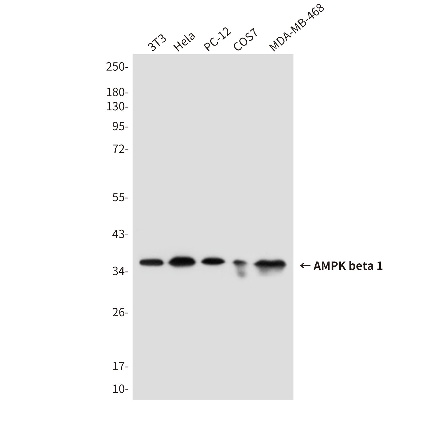 Anti-AMPK beta 1 (1A7) Mouse Monoclonal Antibody