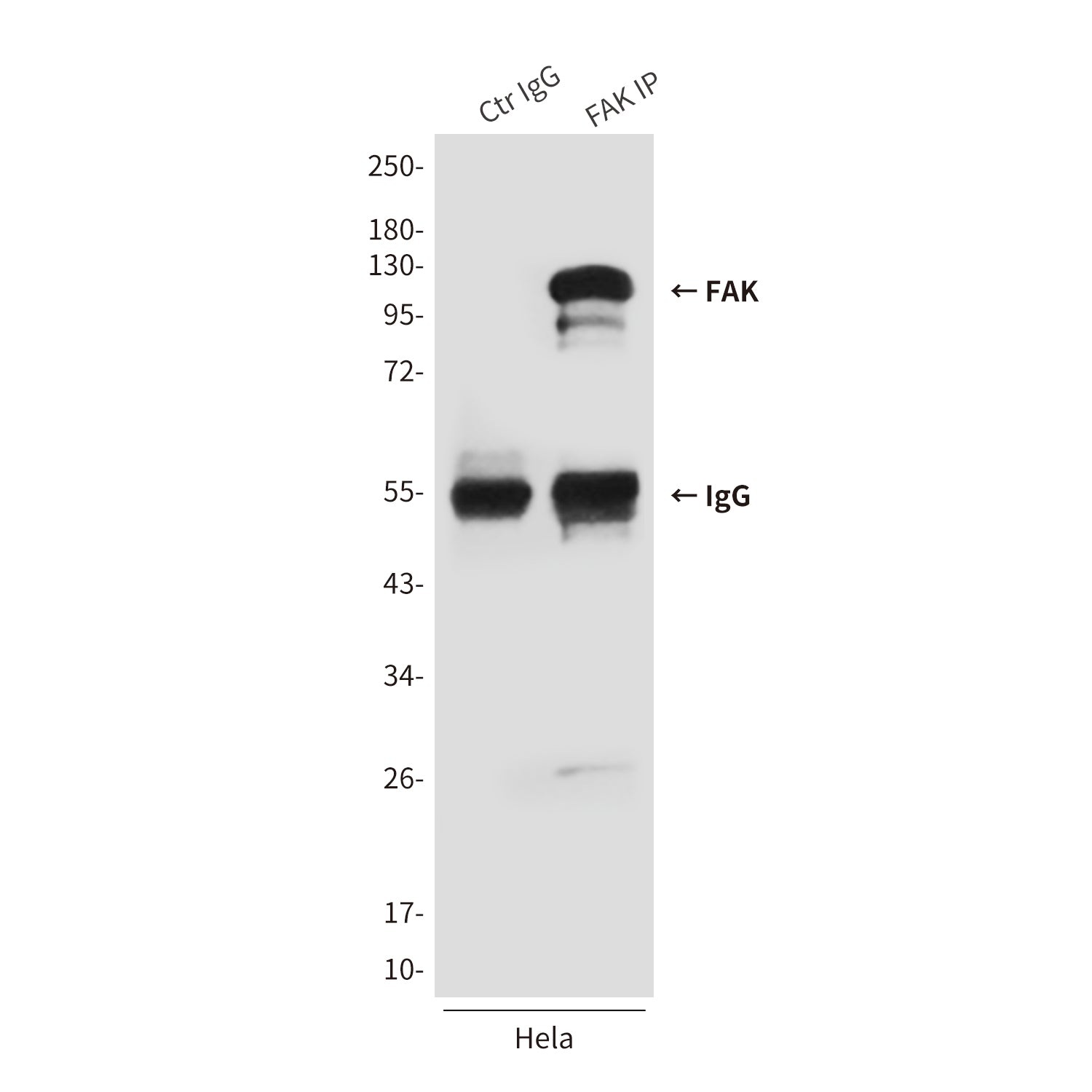 Anti-FAK (3D8) Mouse Monoclonal Antibody