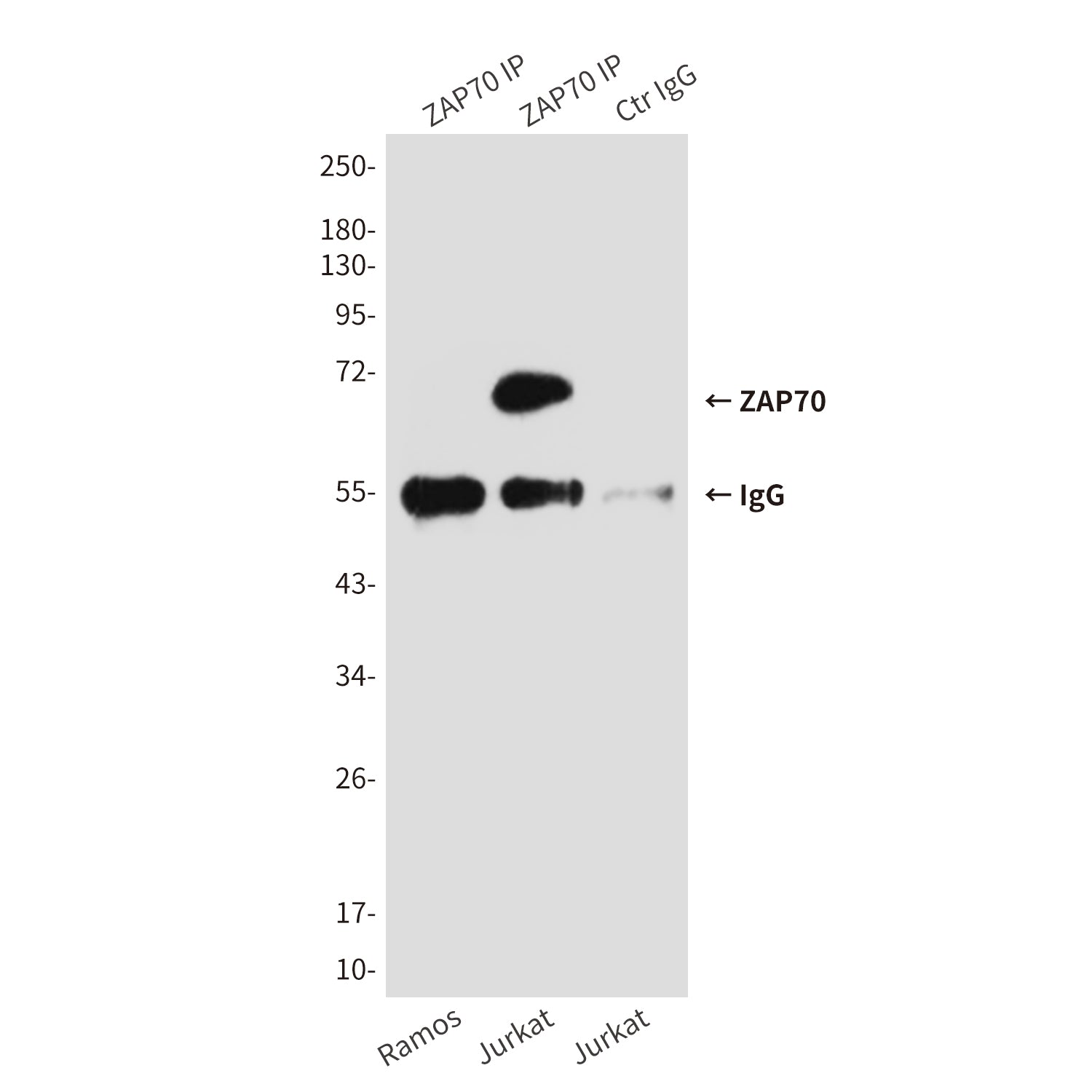 Anti-ZAP70 (4B2) Mouse Monoclonal Antibody